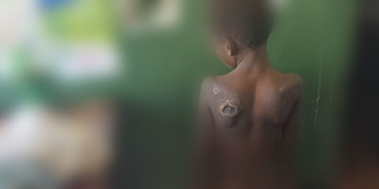 Victim of torture Catherine Kisakye